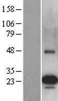 PEMT Protein - Western validation with an anti-DDK antibody * L: Control HEK293 lysate R: Over-expression lysate