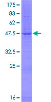 PEMT Protein - 12.5% SDS-PAGE of human PEMT stained with Coomassie Blue