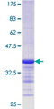 PEPD / PROLIDASE Protein - 12.5% SDS-PAGE Stained with Coomassie Blue.