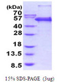 PEPD / PROLIDASE Protein