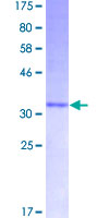 Peptide YY / PYY Protein - 12.5% SDS-PAGE of human PYY stained with Coomassie Blue