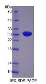 PER1 Protein - Recombinant  Period Circadian Protein 1 By SDS-PAGE