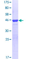 PER2 Protein - 12.5% SDS-PAGE Stained with Coomassie Blue.