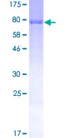 Peripherin Protein - 12.5% SDS-PAGE of human PRPH stained with Coomassie Blue