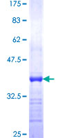 Peripherin Protein - 12.5% SDS-PAGE Stained with Coomassie Blue