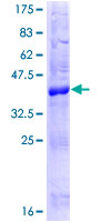PERP Protein - 12.5% SDS-PAGE of human PERP stained with Coomassie Blue