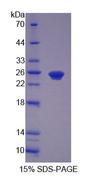 PEX1 Protein - Recombinant Peroxisomal Biogenesis Factor 1 (PEX1) by SDS-PAGE
