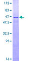 PEX10 Protein - 12.5% SDS-PAGE of human PEX10 stained with Coomassie Blue