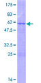 PEX11A Protein - 12.5% SDS-PAGE of human PEX11A stained with Coomassie Blue