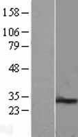 PEX11B Protein - Western validation with an anti-DDK antibody * L: Control HEK293 lysate R: Over-expression lysate