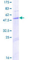 PEX11B Protein - 12.5% SDS-PAGE of human PEX11B stained with Coomassie Blue