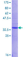 PEX11G Protein - 12.5% SDS-PAGE Stained with Coomassie Blue.