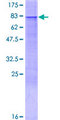 PEX13 Protein - 12.5% SDS-PAGE of human PEX13 stained with Coomassie Blue