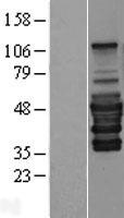 PEX14 Protein - Western validation with an anti-DDK antibody * L: Control HEK293 lysate R: Over-expression lysate