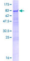 PEX14 Protein - 12.5% SDS-PAGE of human PEX14 stained with Coomassie Blue