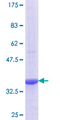 PEX16 Protein - 12.5% SDS-PAGE Stained with Coomassie Blue.