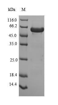 PEX19 Protein - (Tris-Glycine gel) Discontinuous SDS-PAGE (reduced) with 5% enrichment gel and 15% separation gel.