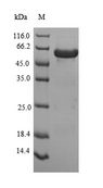 PEX19 Protein - (Tris-Glycine gel) Discontinuous SDS-PAGE (reduced) with 5% enrichment gel and 15% separation gel.