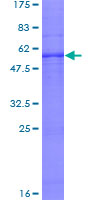 PEX2 / PAF-1 Protein - 12.5% SDS-PAGE of human PXMP3 stained with Coomassie Blue