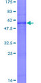 PEX2 / PAF-1 Protein - 12.5% SDS-PAGE of human PXMP3 stained with Coomassie Blue