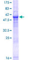 PEX26 Protein - 12.5% SDS-PAGE of human PEX26 stained with Coomassie Blue