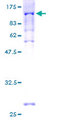 PEX5 Protein - 12.5% SDS-PAGE of human PEX5 stained with Coomassie Blue