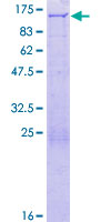 PEX6 Protein - 12.5% SDS-PAGE of human PEX6 stained with Coomassie Blue