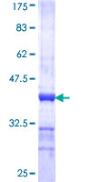 PEX6 Protein - 12.5% SDS-PAGE Stained with Coomassie Blue.