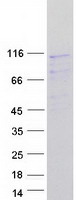 PEX6 Protein - Purified recombinant protein PEX6 was analyzed by SDS-PAGE gel and Coomassie Blue Staining