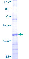 PEX7 Protein - 12.5% SDS-PAGE Stained with Coomassie Blue.