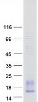 PF4V1 Protein - Purified recombinant protein PF4V1 was analyzed by SDS-PAGE gel and Coomassie Blue Staining