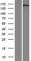 PFAS Protein - Western validation with an anti-DDK antibody * L: Control HEK293 lysate R: Over-expression lysate