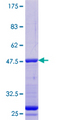 PFDN1 Protein - 12.5% SDS-PAGE of human PFDN1 stained with Coomassie Blue