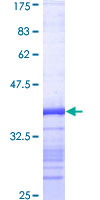 PFDN1 Protein - 12.5% SDS-PAGE Stained with Coomassie Blue.