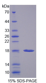 PFDN1 Protein - Recombinant Prefoldin Subunit 1 By SDS-PAGE