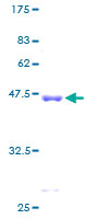 PFDN2 Protein - 12.5% SDS-PAGE of human PFDN2 stained with Coomassie Blue