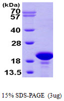PFDN2 Protein