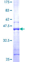 PFDN5 / MM1 Protein - 12.5% SDS-PAGE of human PFDN5 stained with Coomassie Blue