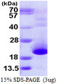 PFDN5 / MM1 Protein