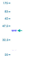 PFDN6 / HKE2 Protein - 12.5% SDS-PAGE of human HKE2 stained with Coomassie Blue