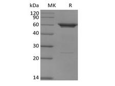PFK2 / PFKFB3 Protein - Recombinant Human PFKFB3 (N-6His)