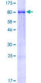 PFK2 / PFKFB3 Protein - 12.5% SDS-PAGE of human PFKFB3 stained with Coomassie Blue