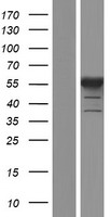 PFKFB2 Protein - Western validation with an anti-DDK antibody * L: Control HEK293 lysate R: Over-expression lysate