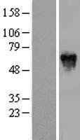 PFKFB2 Protein - Western validation with an anti-DDK antibody * L: Control HEK293 lysate R: Over-expression lysate