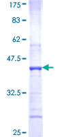 PFKFB2 Protein - 12.5% SDS-PAGE Stained with Coomassie Blue.