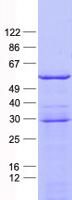 PFKFB2 Protein