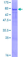 PFKFB4 Protein - 12.5% SDS-PAGE of human PFKFB4 stained with Coomassie Blue