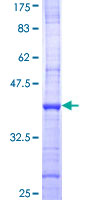 PFKFB4 Protein - 12.5% SDS-PAGE Stained with Coomassie Blue