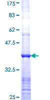 PFKL Protein - 12.5% SDS-PAGE Stained with Coomassie Blue