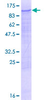 PFKM / PFK-1 Protein - 12.5% SDS-PAGE of human PFKM stained with Coomassie Blue